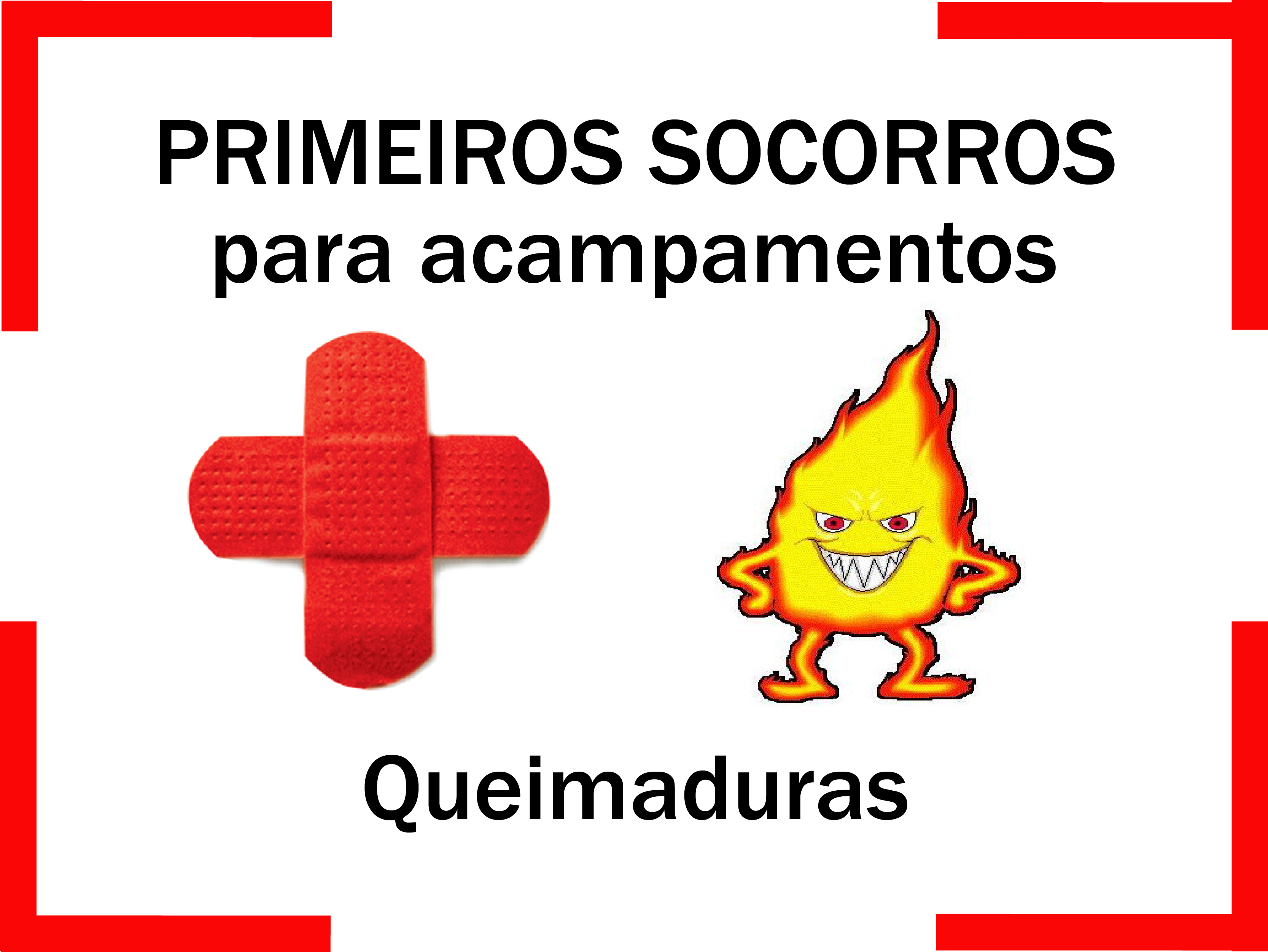 Read more about the article Primeiros Socorros para Queimaduras